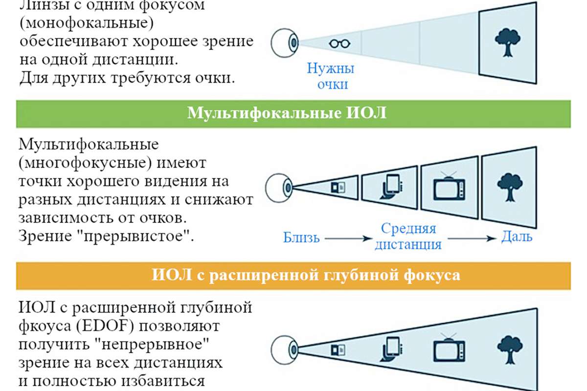 Фото работы по Интраокулярные линзы